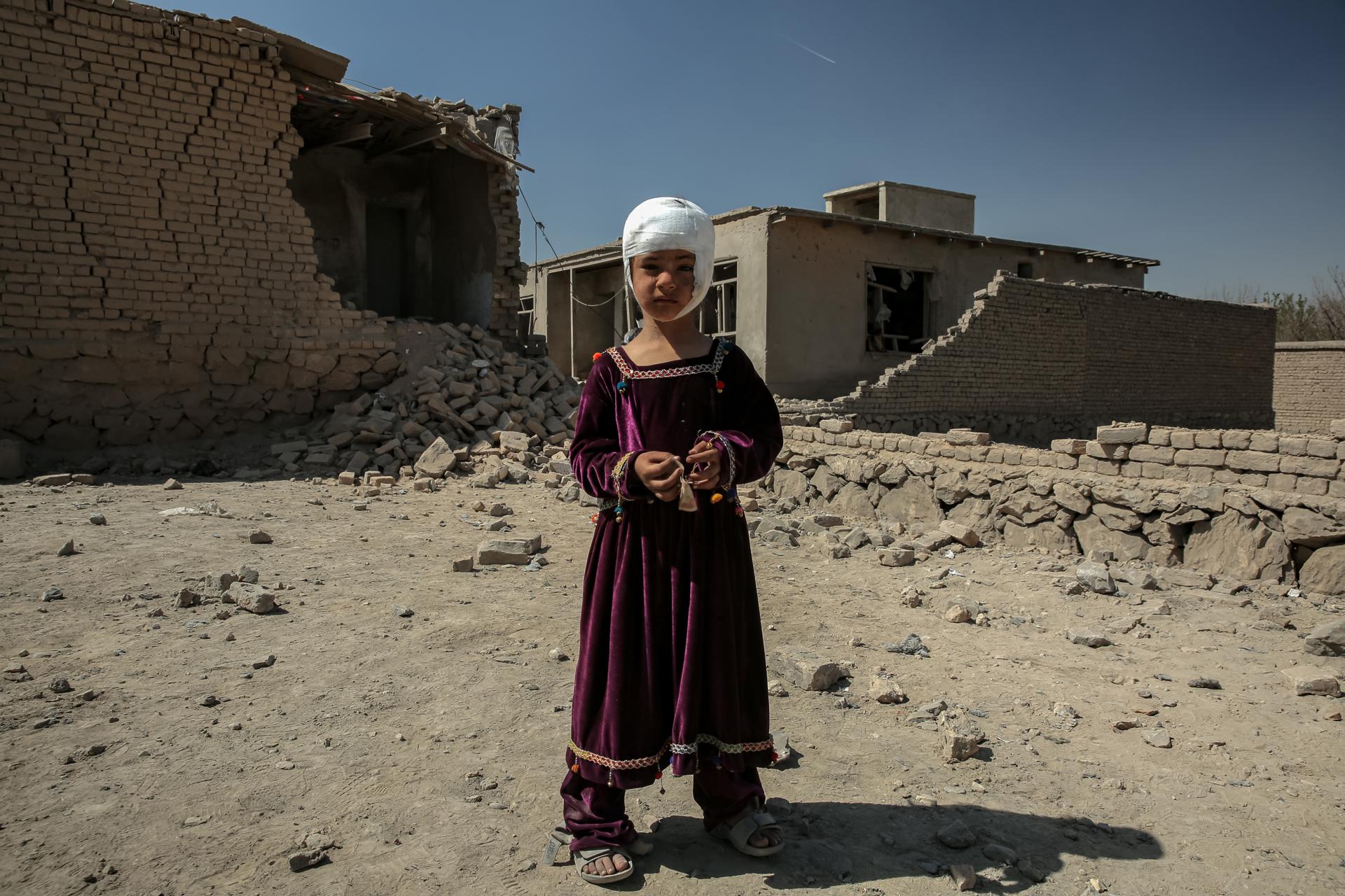 Una nena ferida després d'un presumpte atac pakistanès a Kabul el passat 14 de març Una nena ferida després d'un presumpte atac pakistanès a Kabul el passat 14 de març