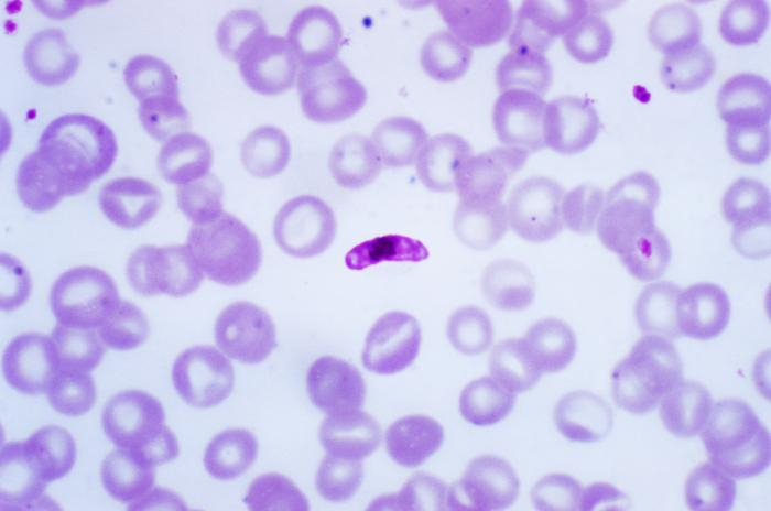 Imatge del ‘Plasmodium falciparum’, causant de la malària