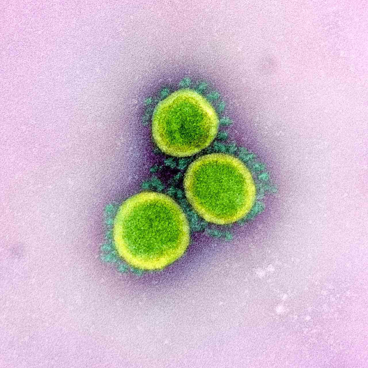 coronavirus